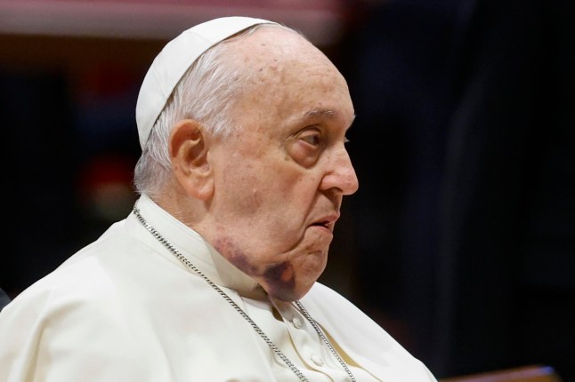 epa11762950 Paus Fransiskus saat upacara konsistori di Basilika Santo Petrus di Vatikan, 7 Desember 2024. Konsistori tersebut berlangsung untuk pelantikan 21 kardinal baru. EPA/FABIO FRUSTACI