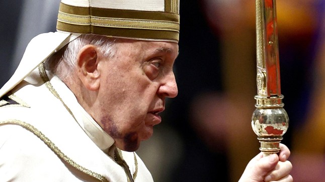 Paus Fransiskus, dengan luka memar besar di dagunya, keluar setelah menghadiri upacara konsistori untuk mengangkat uskup Katolik Roma ke pangkat kardinal, di Basilika Santo Petrus di Vatikan, 7 Desember 2024. REUTERS/Guglielmo Mangiapane